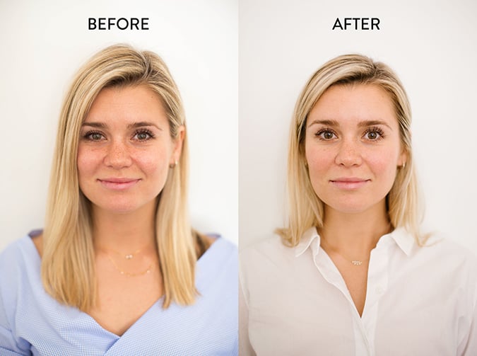 Our editor's before-and-after baggy eye fix